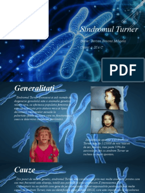 Реферат: Turners Syndrome Essay Research Paper Kalene SzymczakJanuary